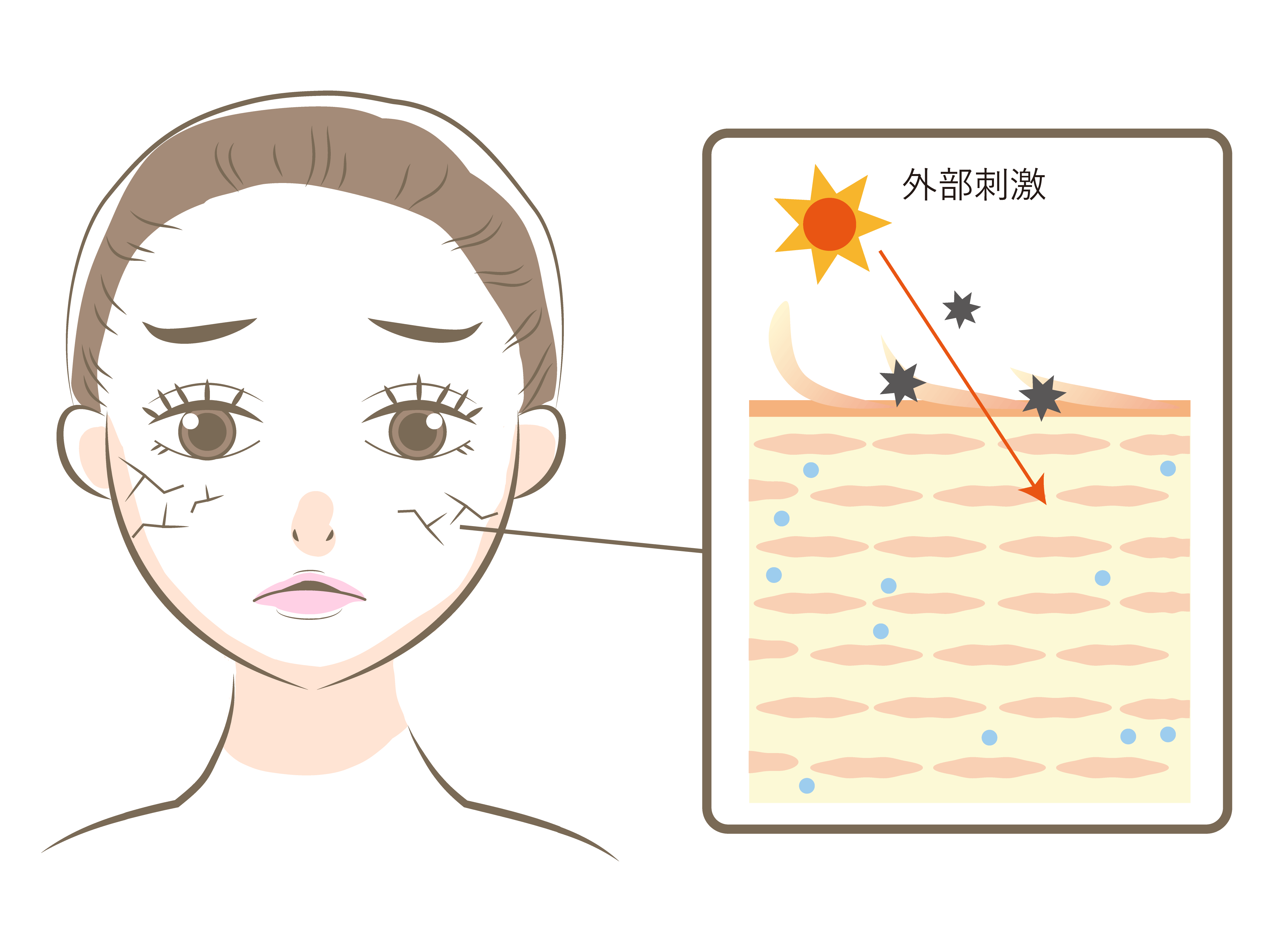 乾燥に悩む女性のイラストと、バリア機能が低下し外部刺激が浸入する肌内部のイメージ。