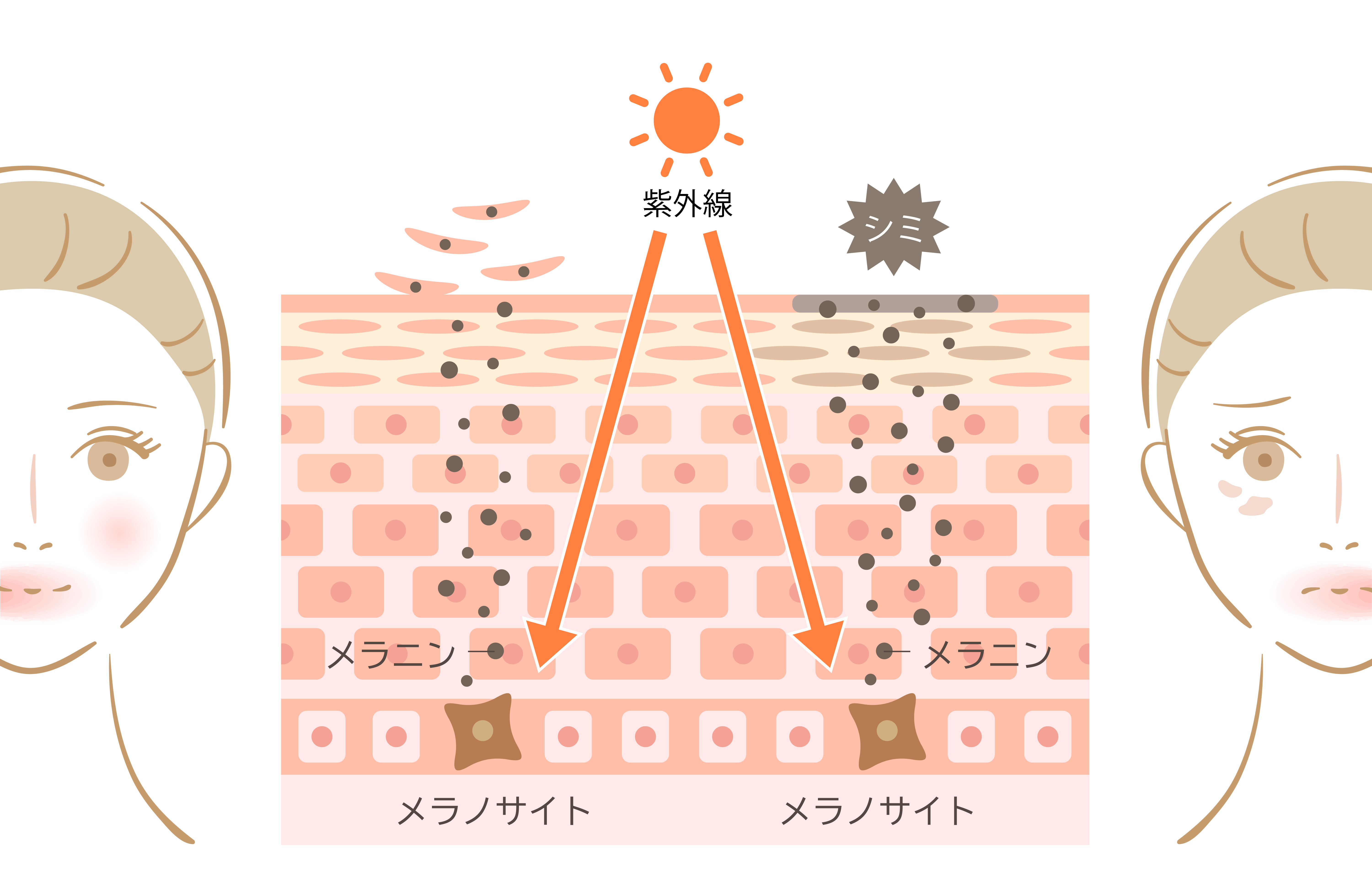 紫外線を浴びた肌の内部でメラニンが作られ、表面にシミとなって現れる仕組みのイメージ図。左右で健やかな肌と悩める肌を比較イメージ
