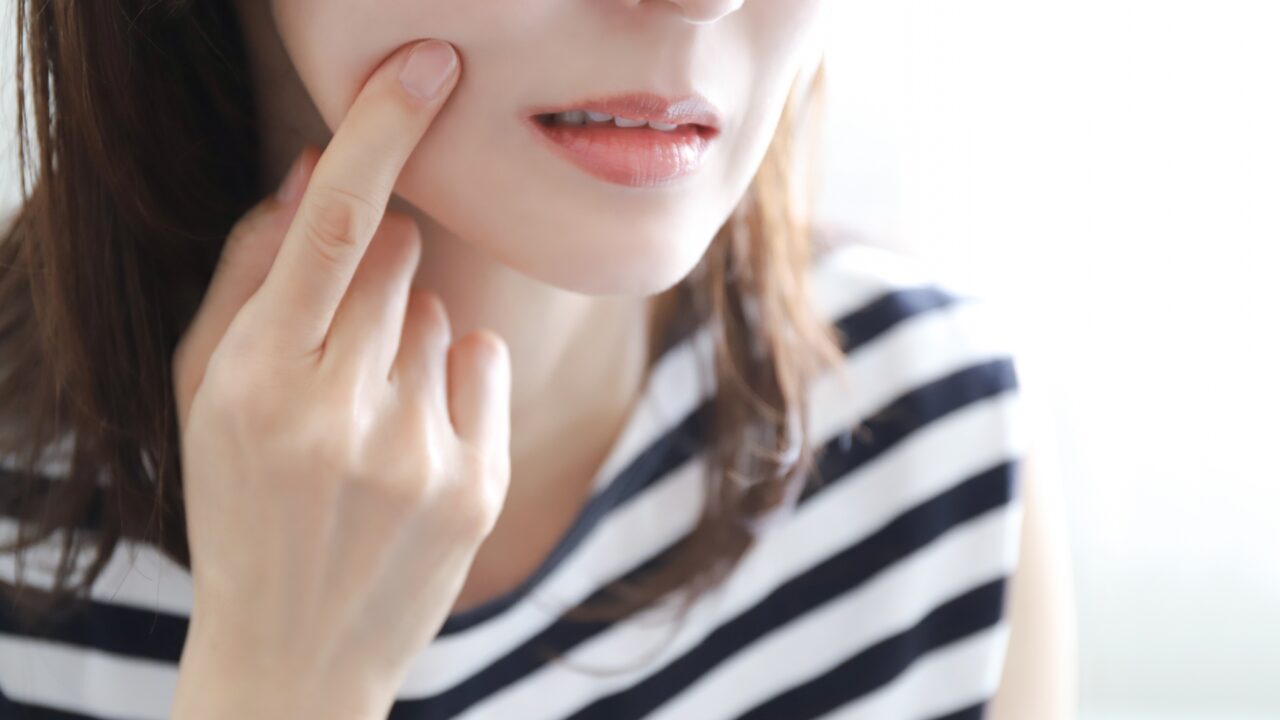 女性が、頬の赤みやポツポツを気にして指を添えている様子