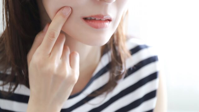 女性が、頬の赤みやポツポツを気にして指を添えている様子