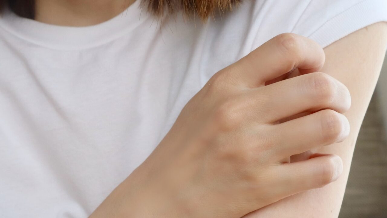 乾燥肌による肌のカサカサやかゆみが気になり、腕に手を当てている様子
