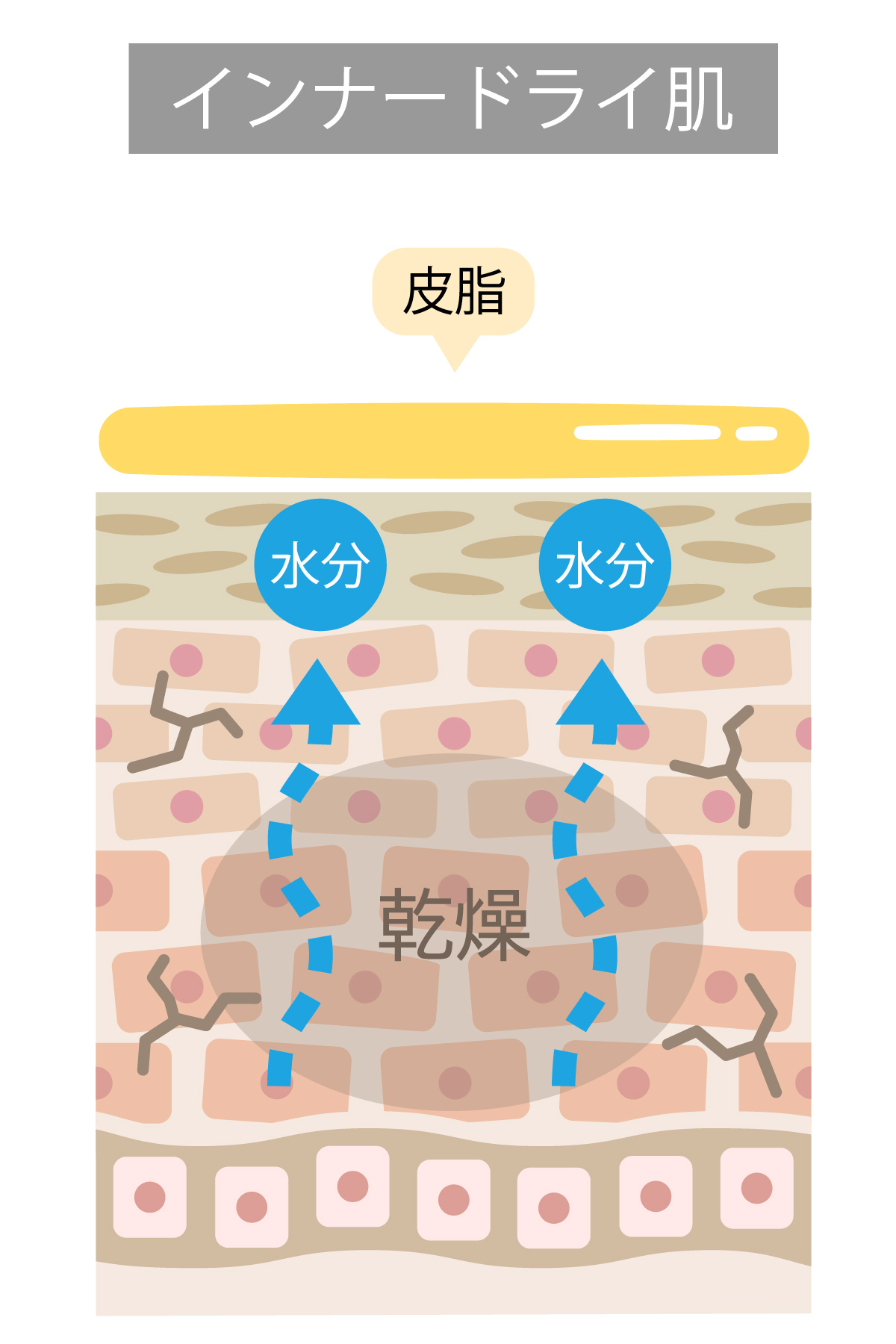 「インナードライ肌」の肌断面図解。肌表面は「皮脂」でベタつくが、角質層の「乾燥」が進み、内部の「水分」が蒸発してしまっている様子のイラスト